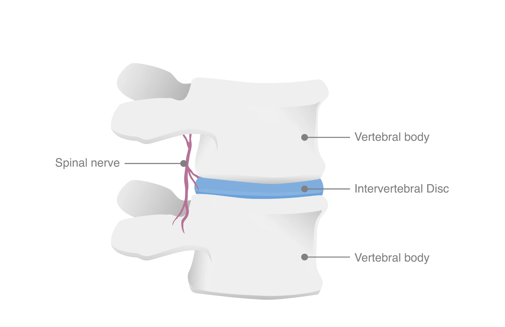 Anatomical illustration of the lumbar spine showing the vertebral bodies, intervertebral disc and spinal nerve