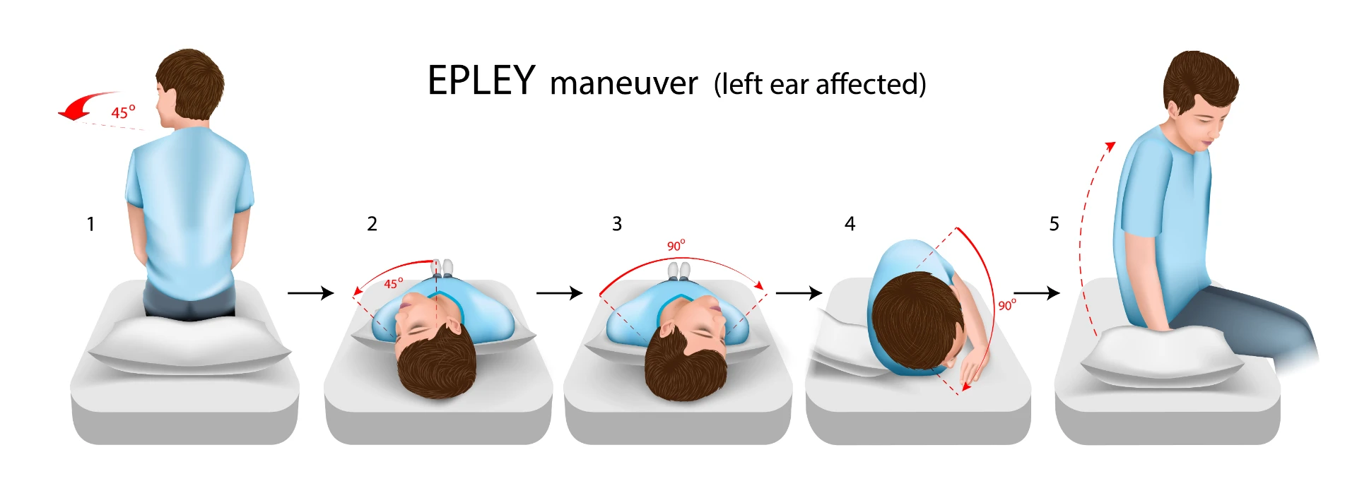 Epley manoeuvre positions used to treat posterior canal BPPV